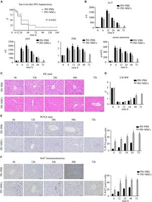 Mesenchymal Stem Cells Improve Glycometabolism and Liver Regeneration in the Treatment of Post-hepatectomy Liver Failure